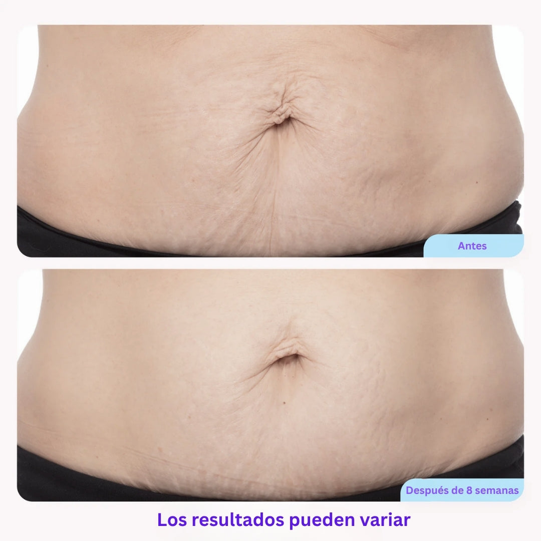 Tighten & Smooth Belly Cream