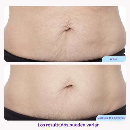 Tighten & Smooth Belly Cream