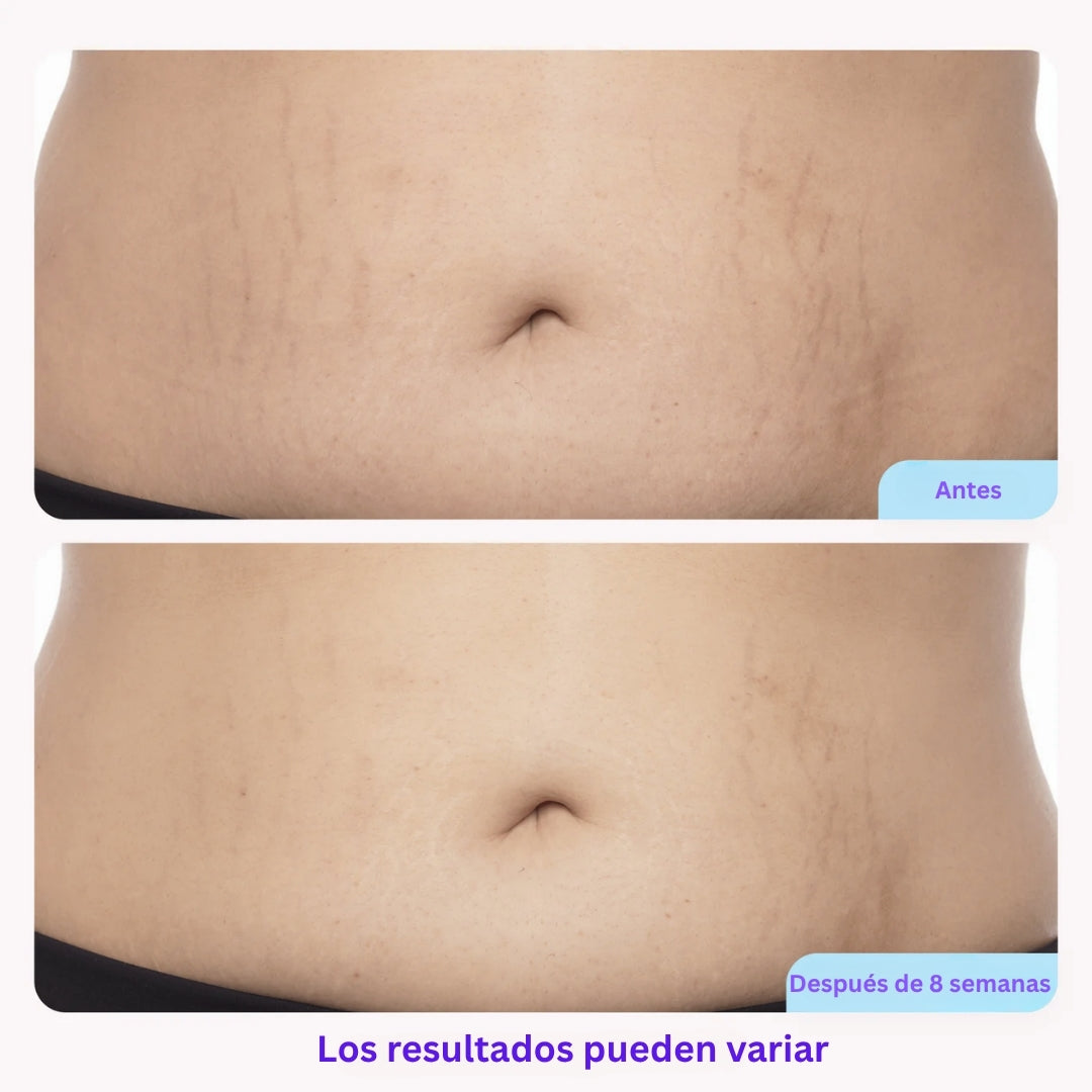 Tighten & Smooth Belly Cream