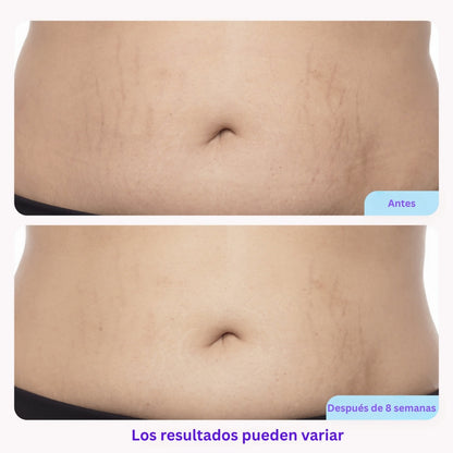 Tighten & Smooth Belly Cream