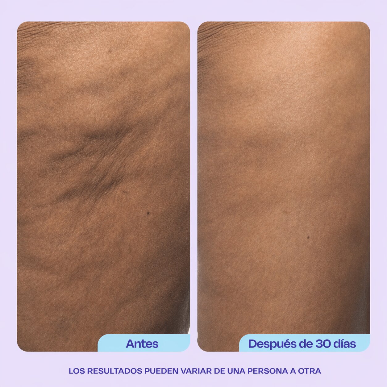 Firming Butt & Thigh Cream