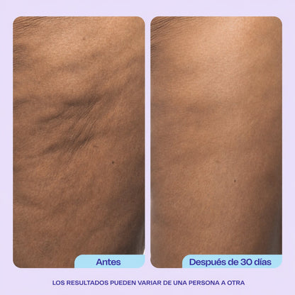 Firming Butt & Thigh Cream