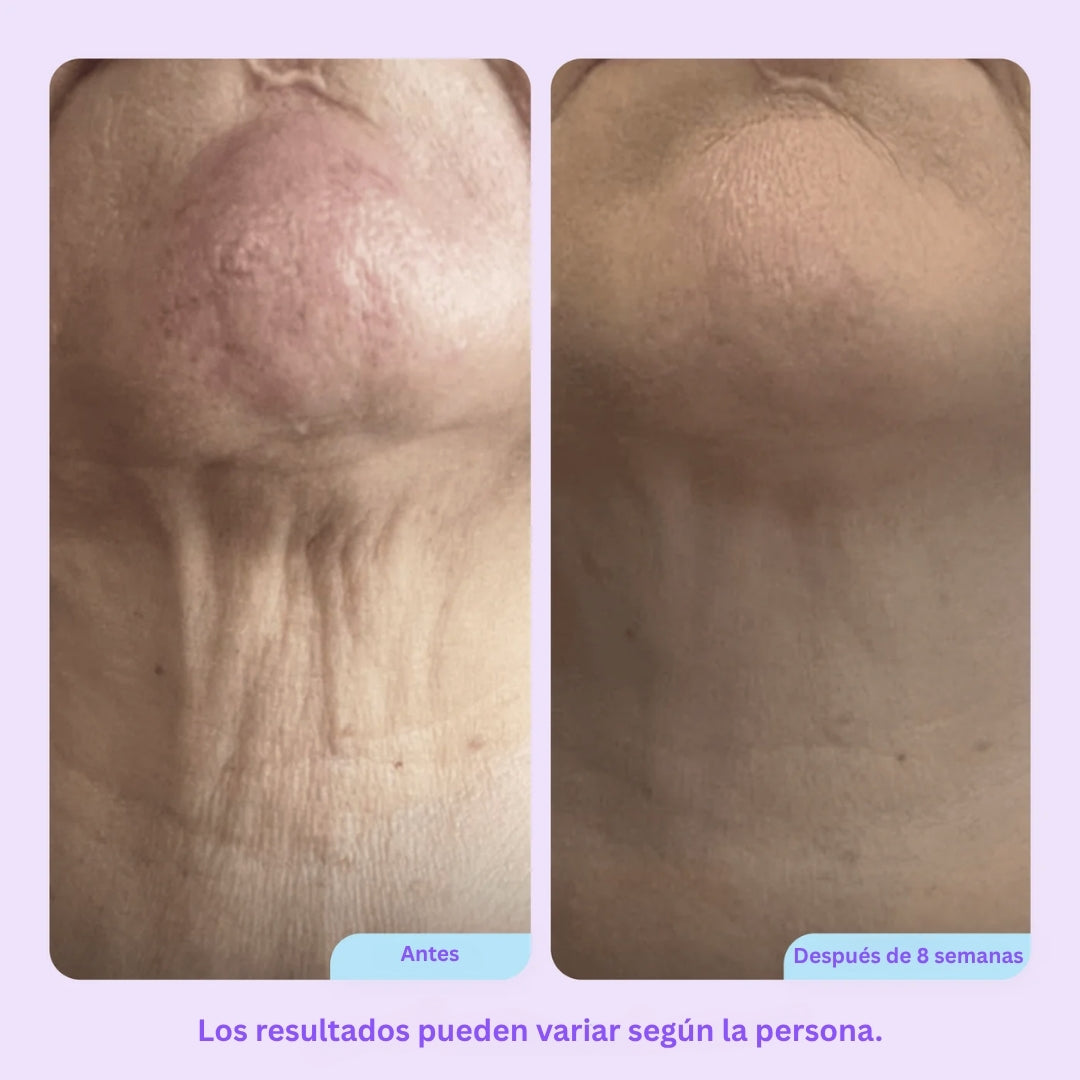 Tighten & Lift Neck Cream